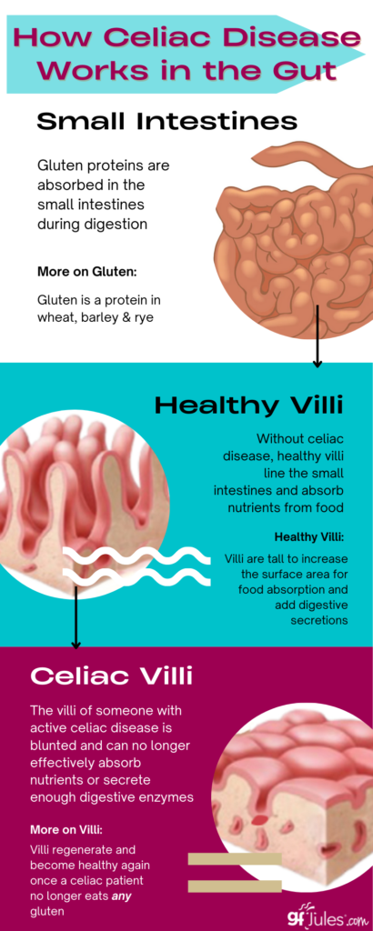 How Celiac Disease Affects the Small Intestines and Villi | gfJules